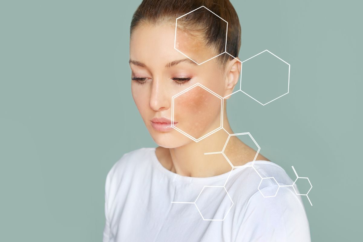 Pelle rovinata di una donna